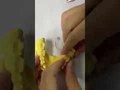 Comfortable To Wear AMD Dental Lab's Hawley Retainer For Safe And Healthy Orthodontics