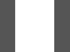 Dental Root Canal Sonic Irrigator Activator Endodontic Cleaning 60pcs Endo Tips