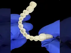 Zirconia Dental Bridge Strong and Natural Looking Restoration for a Seamless Smile
