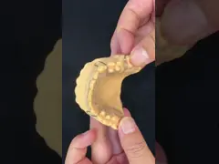 Perfect Fit Germany Ortho Teeth Halley Retainer for Esthetics and Adjustability Clear Shade SDL Dental Lab