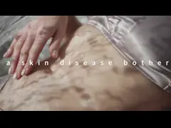 2 In 1 Skin Beauty Machine Multifunction DPL System And Nd Yag Laser Handpiece