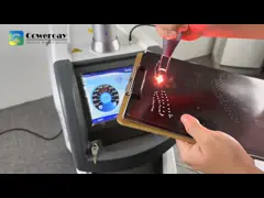 Пикосекундная машина для удаления пигментации Nd Yag Laser Tatoo Remove Machine video