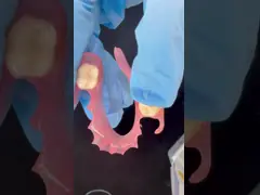 3D Print Model Dental TCS Valplast Flexible Partial Dentures Pink / Dark Color Dental Lab Product