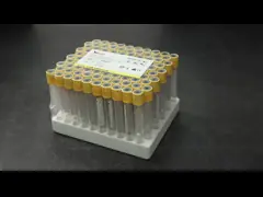 5ml 6ml 7ml 8ml Gel And Clot Activator Yellow Serum Separator Clot Activator Tube