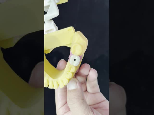 Screw Retained PFZ Porcelain Layered Zirconia Dental Implant Crown from Dental Lab ISO FDA CE Certified with 5-Year Guarantee