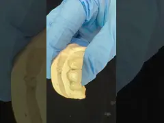 Strong Layered Zirconia Crown And Bridge In Good Esthetics Zirconia Layered China Dental Lab