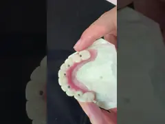 5 Year Guarantee Dental Implant Crown PMMA Bridge Over Multi Unit Abutments Customized Vita Shade