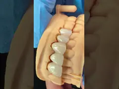 High Aesthetic Anterior Teeth Full Contour Zirconia Crown with Customized Vita Shade Dental Lab