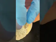 Dental Digital Full Zirconia Crown With 3D Print Model SDL Dental Lab Zirconia Onlay