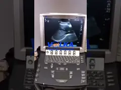 Sonosite M-Turbo Original Ultrasound Mainboard P12095-15*A