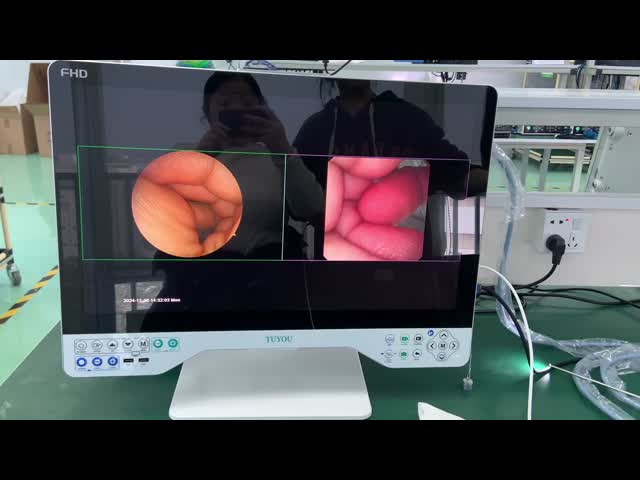 1080P フルHD内視鏡システム 頑丈で柔軟 24インチ オールインワンビデオレコーダーカメラ