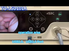 TUYOU Ultra HD Medische 4K-endoscoopcamera voor Ultrasone van kankerendometriumpoliepen