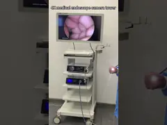 Hoogwaardige 4K medische endoscopie videocamera systeem voor laparoscopie toren Urologie AWB ondersteund