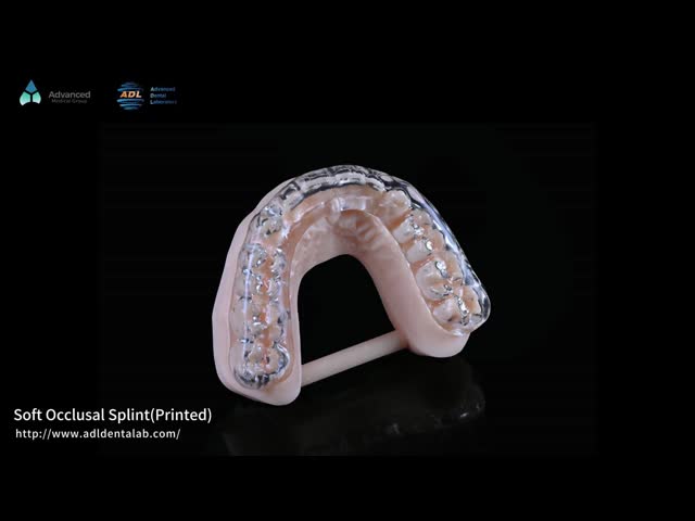 Talas de oclusão macia impressas em 3D para bruxismo