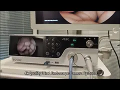 Sistema di telecamere endoscopiche mediche TUYOU 4K con sorgente di luce fredda per ENT, Urologia e Laparoscopia