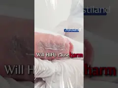 Miglior macchina Hifu per uso domestico Stringing e lifting della pelle preciso e mirato