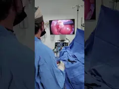 TUYOU 4K Full HD Cystoscopy Camera Endoscoop Camera Voor Ectopic Laparoscopy