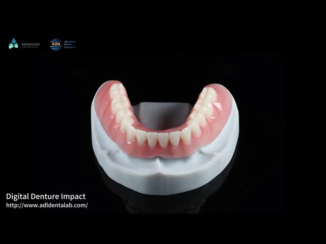 Alta estética Dentadura removível completa acrílica Dentadura completa acrílica
