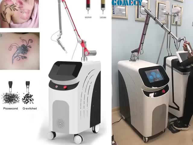 Q スイッチ付き Nd Yag レーザーボディマシン レーザー皮膚処理マシン 眉毛タトゥー タトゥー機器
