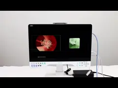 TUYOU UHD Endoscopio Endoscopio medico Camera per l'uso di strumenti di neurochirurgia