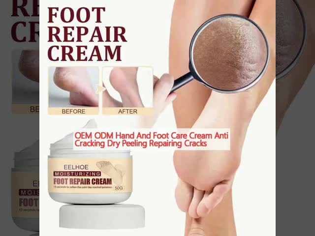 OEM ODM Creme de cuidados com as mãos e os pés Anti-cracking Peeling seco Reparação de rachaduras