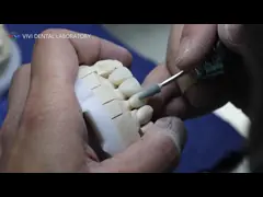 Solid Dental Lab Crowns 3D Pro High Translucency Full Zirconia Crowns China Dental Lab