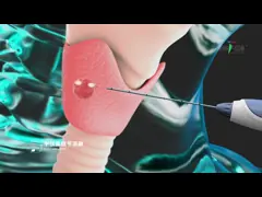 Adjustable Tumor Ablation And Cutting Electrode with Radio Frequency