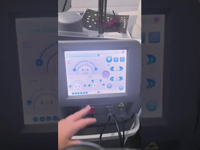 755nm 1604nm Nd Yag ALEXレーザー ロングプラス脱毛機