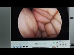 Système endoscopique avancé 4 en 1 avec imagerie rigide et flexible simultanée