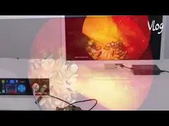 TUYOU Hersteller Full HD Medizinische Bildgebung Endoskopie Kamerasystem für Urologie Chirurgie und ENT