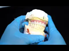 Good Fitting Precise Esthetic Zirconia Porcelain Crown Pink Porcelian With Bleaching Shade