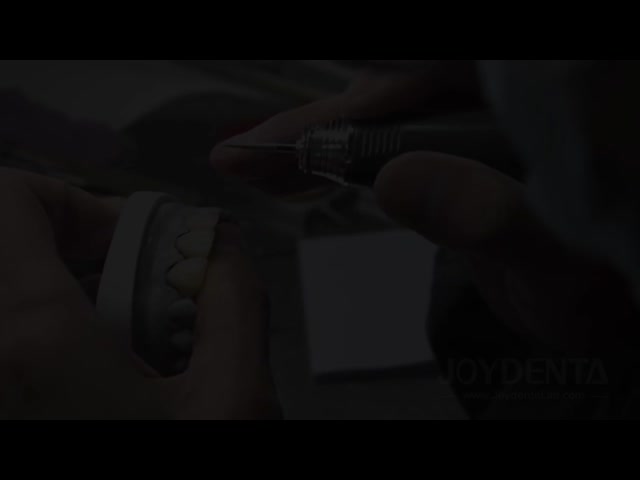 快適な歯科フェニール 歯のエナメルと強い結合 安全なフィット 軽量でスムーズで最適な患者快適性