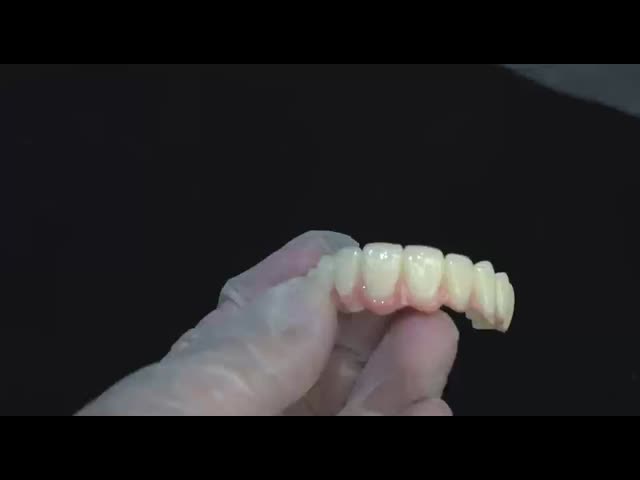 Porcelana All On Four Ponte de zircônio Ponte de implantes dentários de alta estética