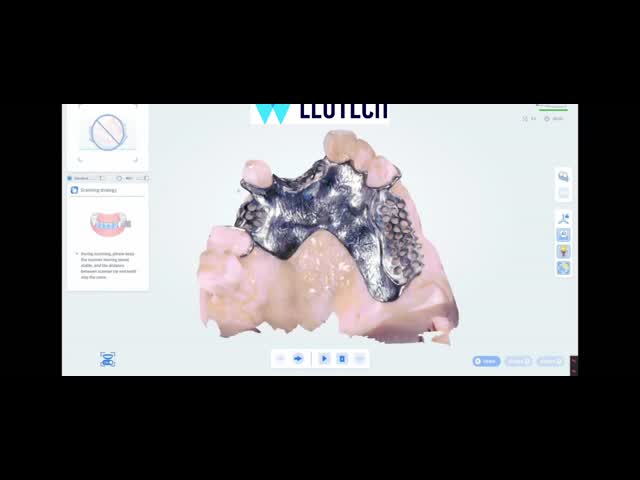 Versatile LMAI-30 3D Scanne 25mm Depth for Implants Ortho & Prosthodontic Solutions