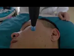 Acne Removal Wrinkle Scar Eyelid Lift Cold Plasma Machine