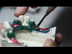 Telescope Inner Co-Cr And Outer Co-Cr Metal Partial With Composite