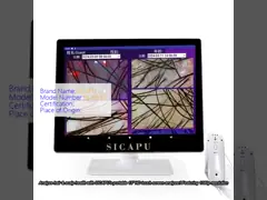 Portable 15 Inch HD Touch Screen Hair Scanner Machine 1080p Hair And Scalp Analyzer