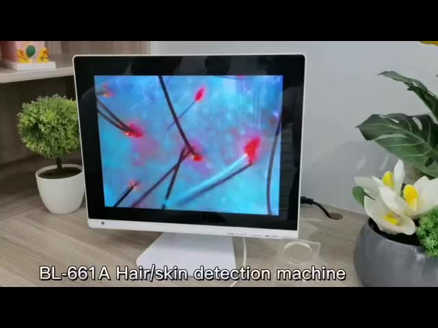 High-Definition 15 Inches AI Hair Testing Machine - Smart Detection for Hair Damage & Nutrition