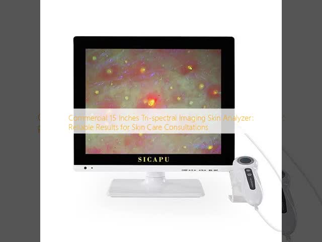 Commercial Skin Analyzer 15 Inches Tri Spectral Imaging For Skin Care Consultations