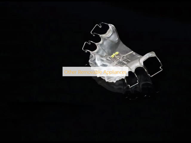 Removable Orthodontic Appliance For Easy To Clean Convenient Removal With Worry Free Correction
