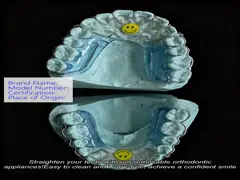 Removable Orthodontic Appliance For Easy To Clean Convenient Removal With Worry Free Correction