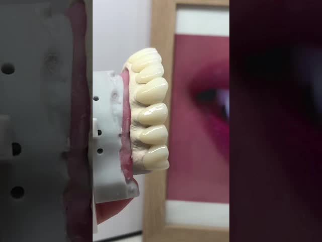 The Strength of Titanium, The Art of Natural Aesthetics.