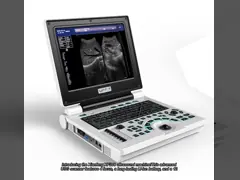 China Win7 System Portable Color Doppler Ultrasound Scanner 3200mAh Battery supplier