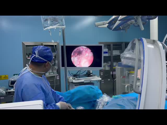 Hydrophobic Coated Double Ureteral Stent Radio Opaque Large Lumen URS Stent