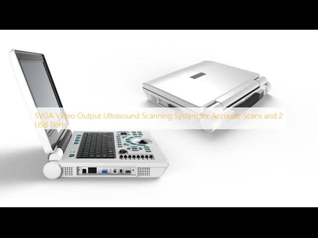 SVGA Video Output Ultrasound Scanning System for Accurate Scans and 2 USB Ports