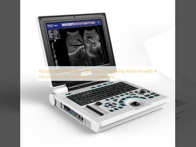 Advanced Technology Ultrasound Scanning Machine with 4 Focus and Long-Lasting Li-ion Battery