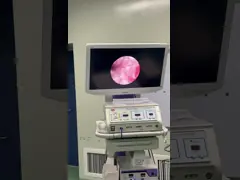 China Radiation Reduced Nephrostomy Catheter Kit With Enhanced Imaging Features supplier