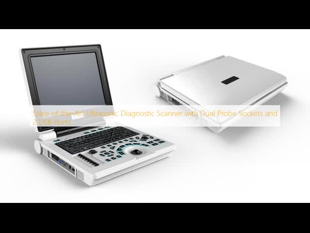 State-of-the-Art Ultrasonic Diagnostic Scanner with Dual Probe Sockets and 2 USB Ports