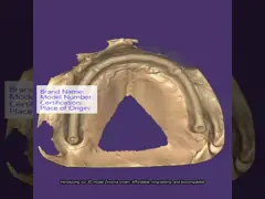 3D model Zirconia crown