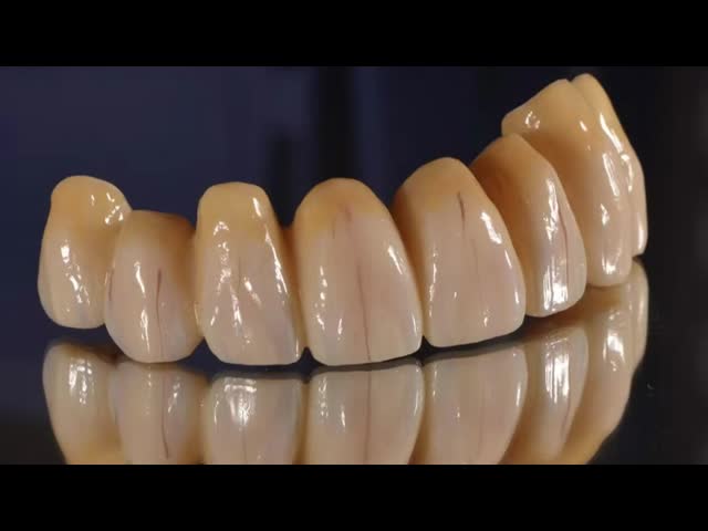 High Precision Zirconia All Ceramic Crown With Transparent And Moist Color
